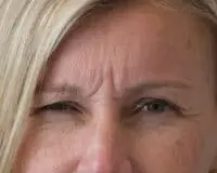 A woman with wrinkles on her forehead and face.