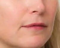 A woman with a very small nose and chin.