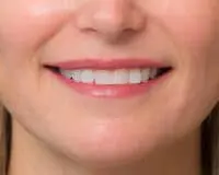 A woman with pink lips and white teeth.