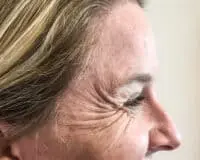 A woman with wrinkles on her face and neck.